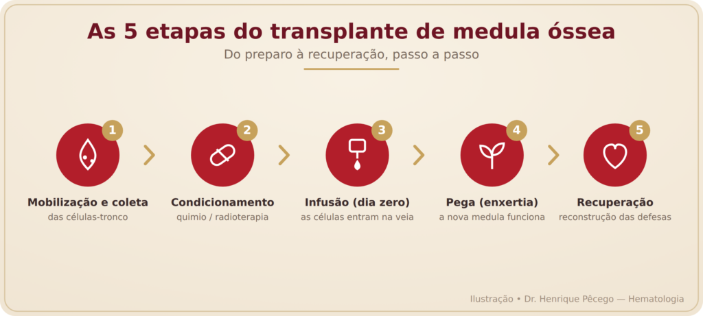 As 5 etapas do transplante de medula óssea: mobilização e coleta, condicionamento, infusão (dia zero), pega e recuperação