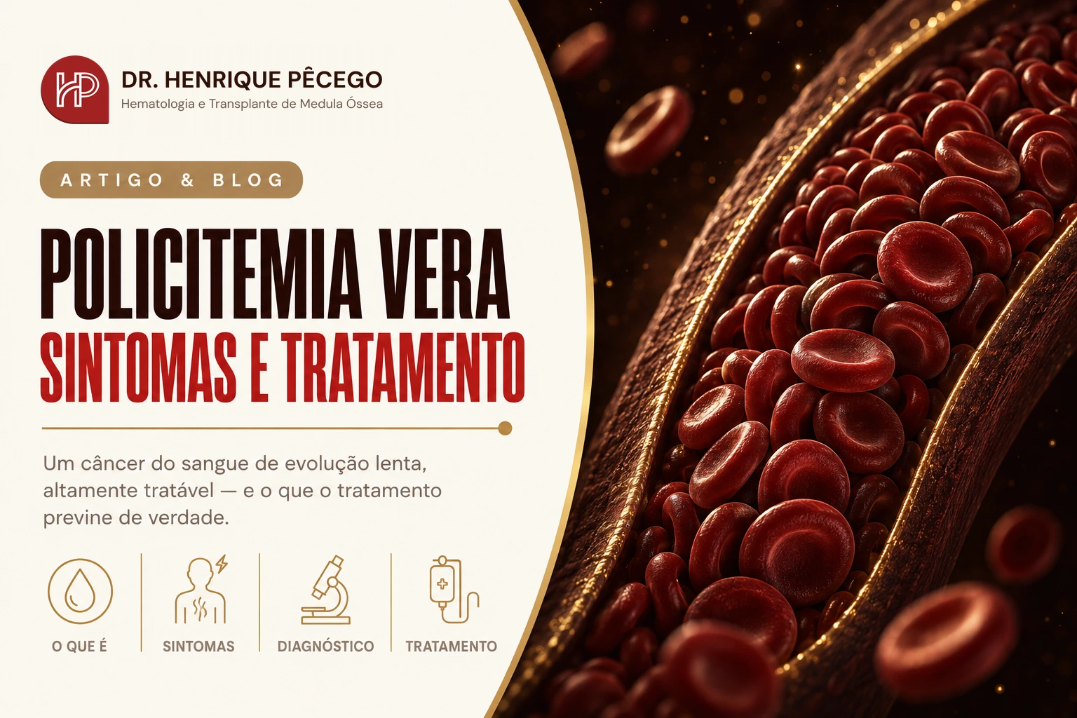 Policitemia vera: sintomas, exames e tratamento