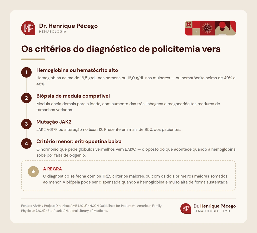 Infografico com os tres criterios maiores e o criterio menor do diagnostico de policitemia vera