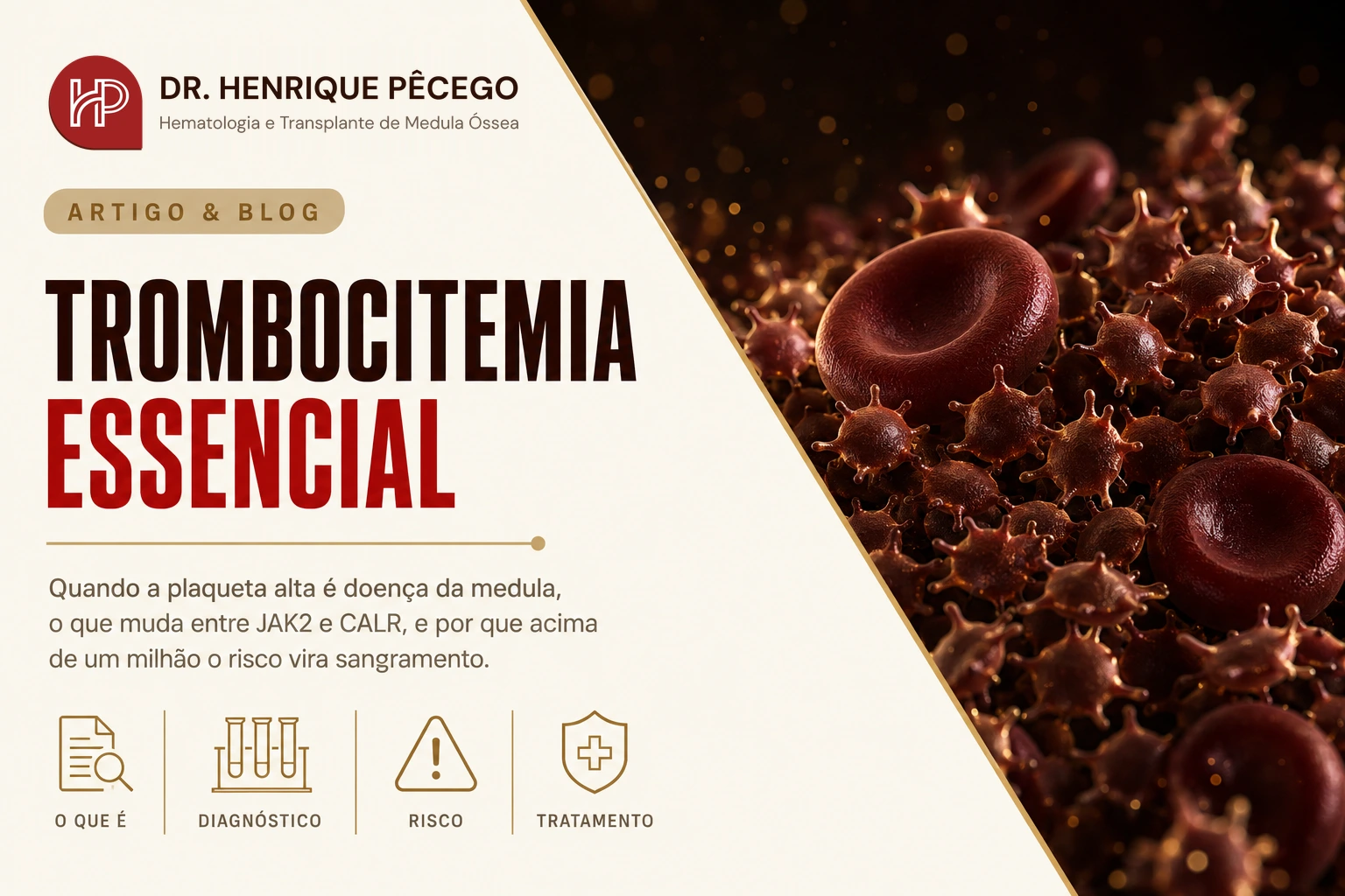 Trombocitemia essencial: o que é e como tratar