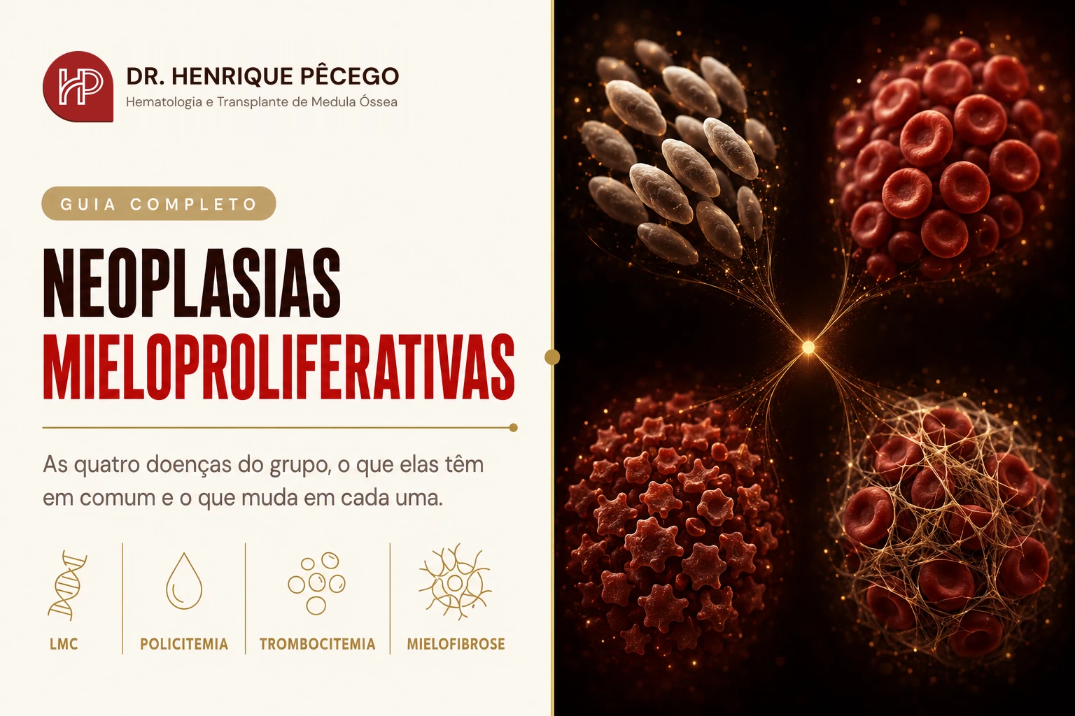 Neoplasias mieloproliferativas: o guia completo