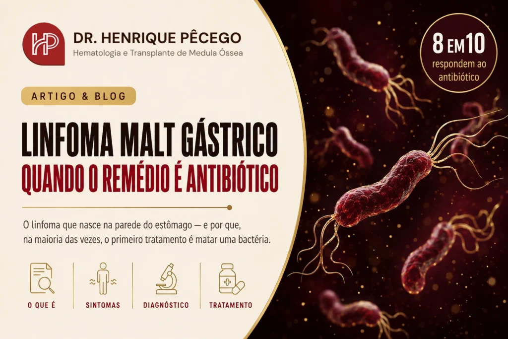 Linfoma MALT gástrico: o que é e tratamento