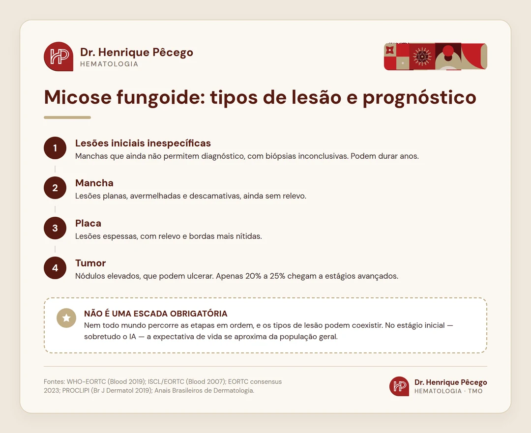 Infográfico: as quatro fases da micose fungoide e o prognóstico