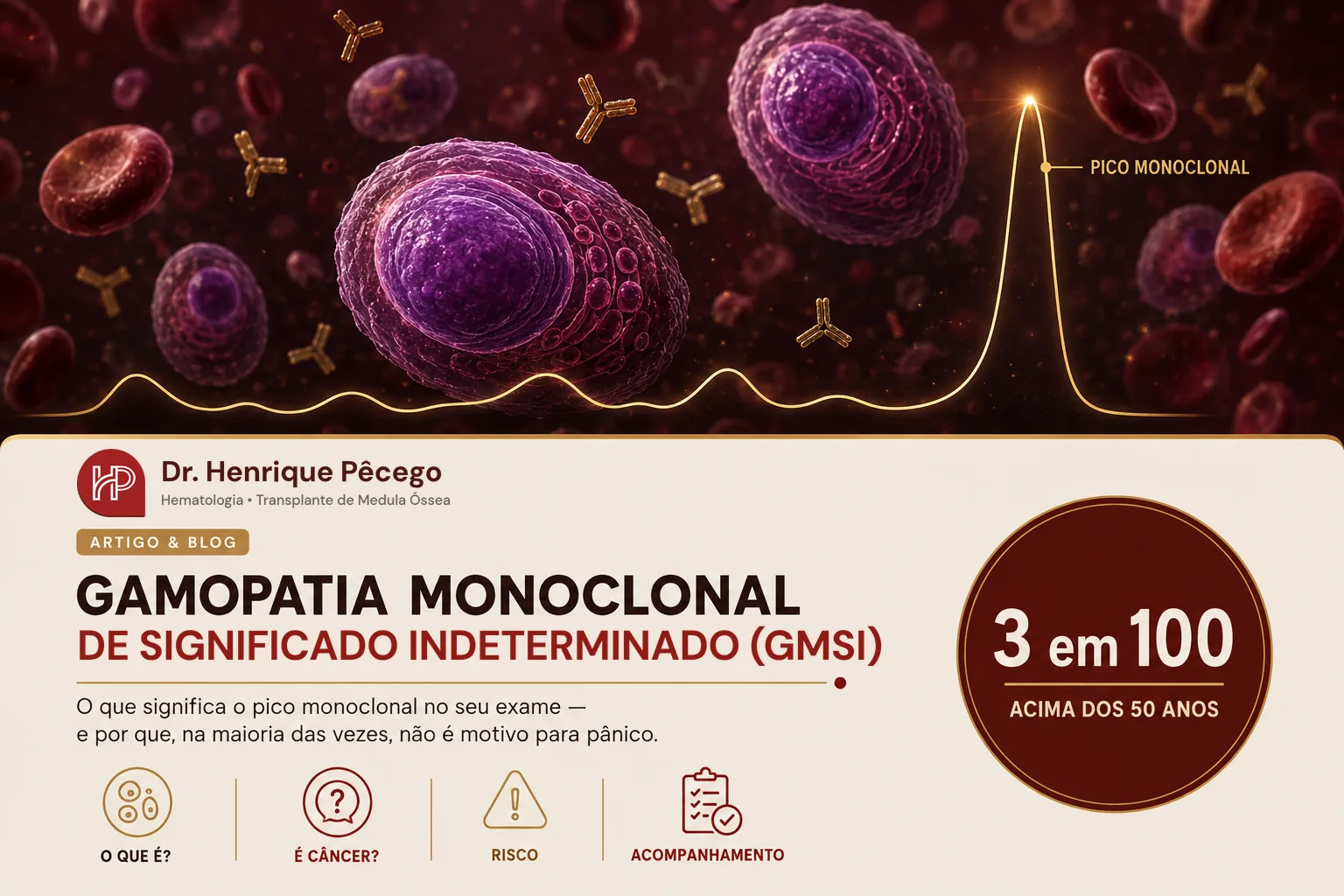Gamopatia monoclonal de significado indeterminado (GMSI)