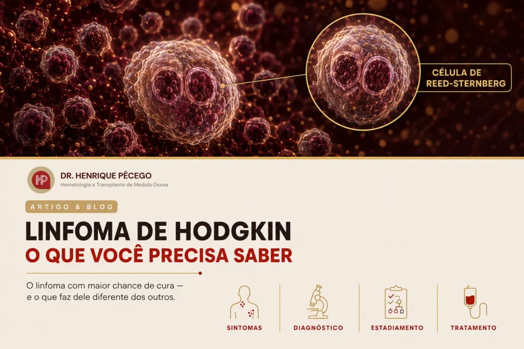 Linfoma de Hodgkin: o que é, sintomas, diagnóstico e tratamento