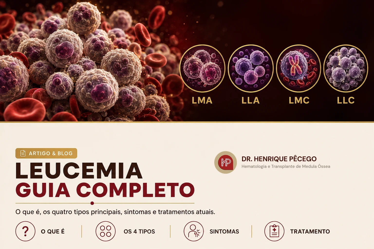 Leucemia: o que é, tipos, sintomas e tratamentos (guia completo)