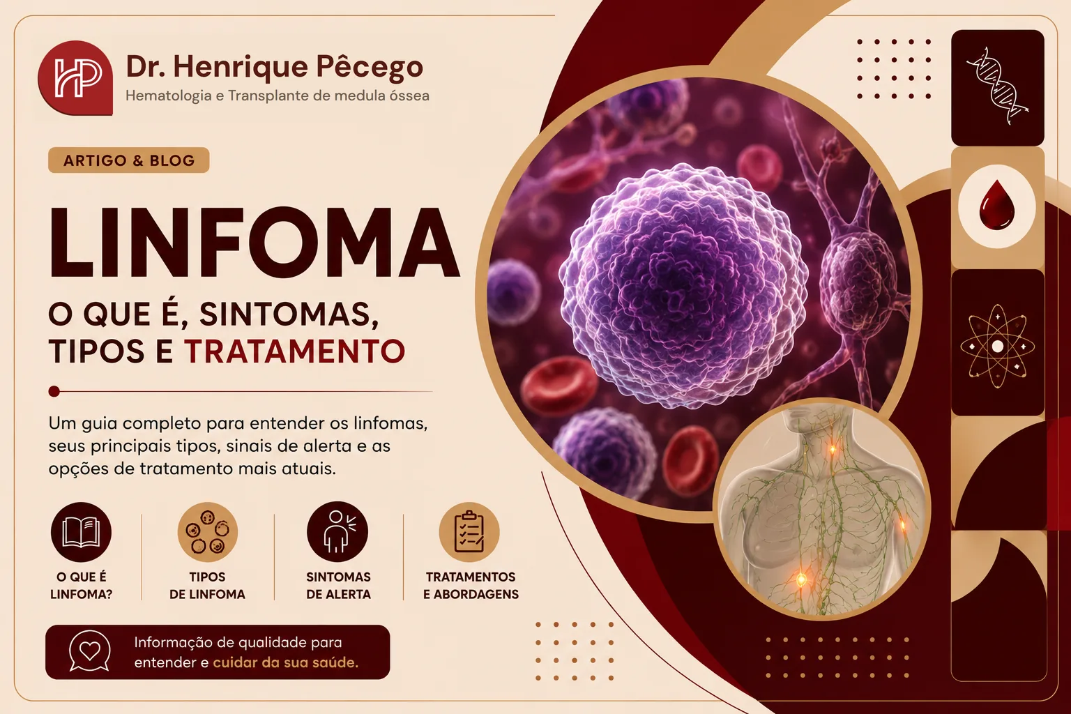 Linfoma: o que é, sintomas, tipos, diagnóstico e tratamento