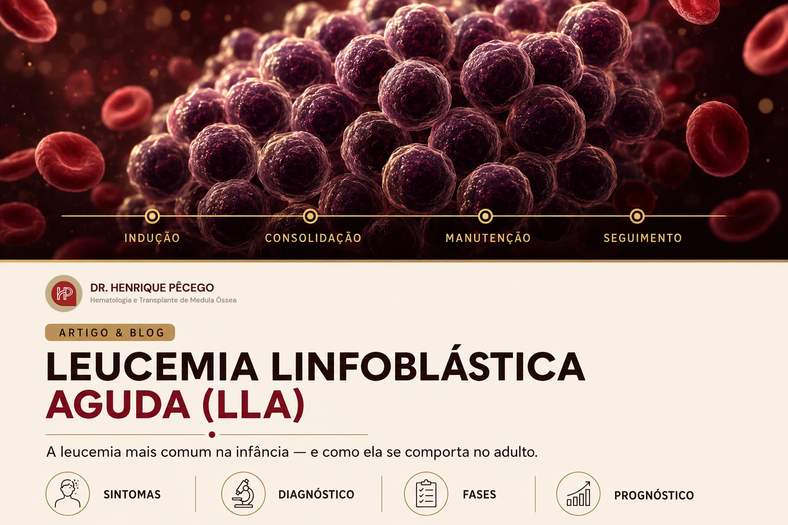 Leucemia linfoblástica aguda (LLA): o que é, sintomas, diagnóstico e tratamento