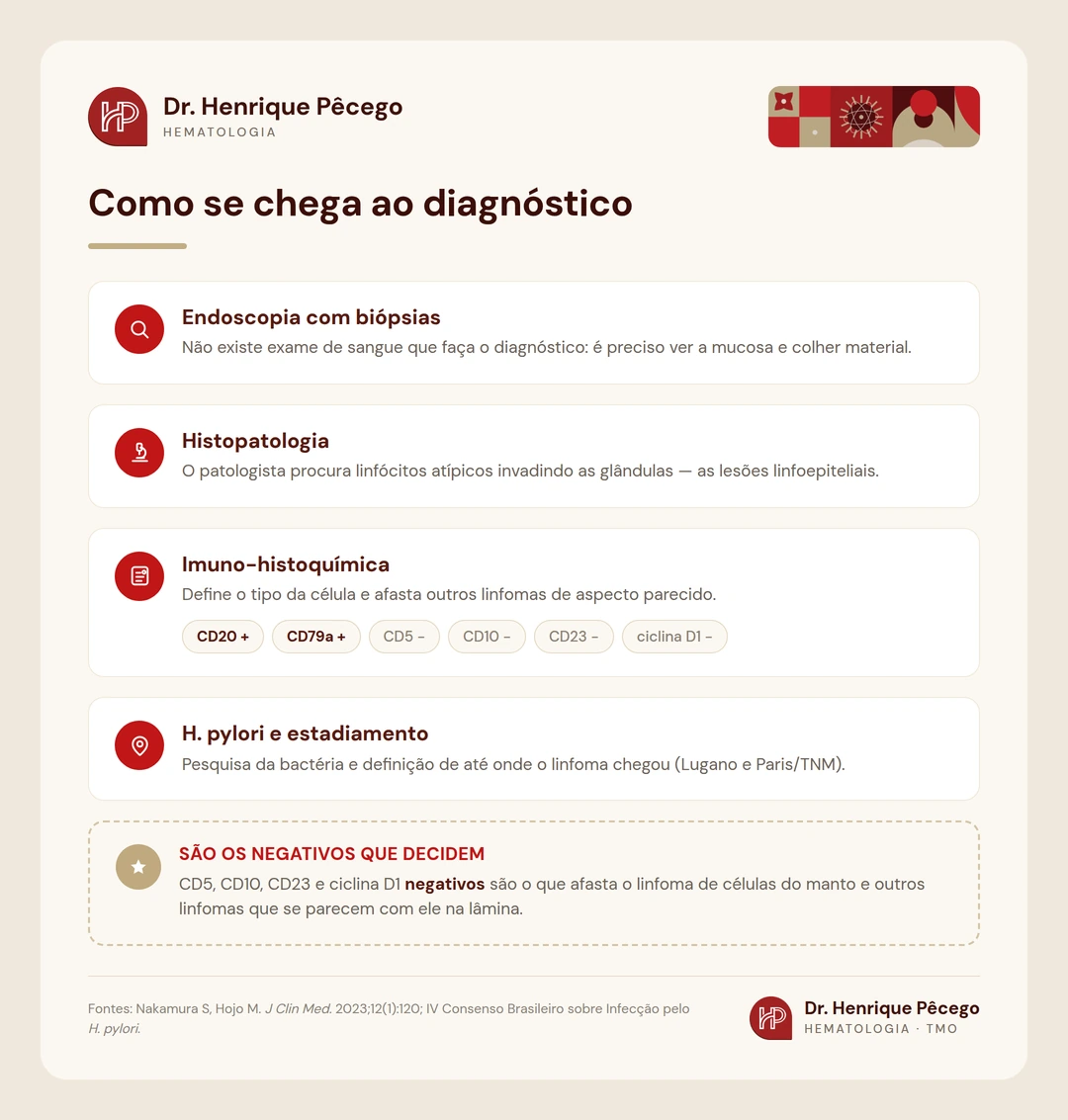 Os quatro passos do diagnóstico do linfoma MALT gástrico: endoscopia com biópsias, histopatologia, imuno-histoquímica com CD20 positivo e ciclina D1 negativa, e pesquisa do H. pylori com estadiamento