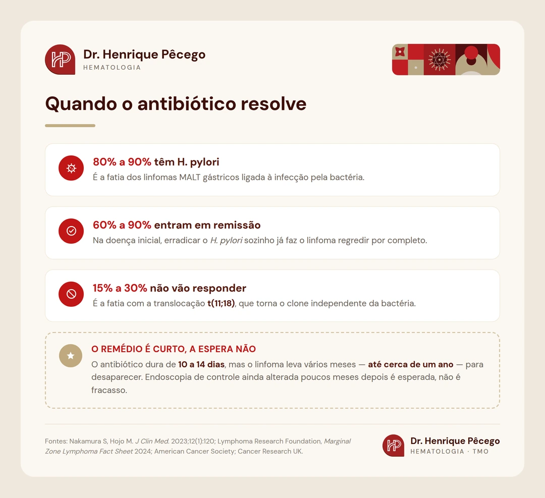Três números do linfoma MALT gástrico: 80 a 90 por cento têm H. pylori, 60 a 90 por cento entram em remissão completa com a erradicação e 15 a 30 por cento têm a translocação t(11;18) e não respondem ao antibiótico