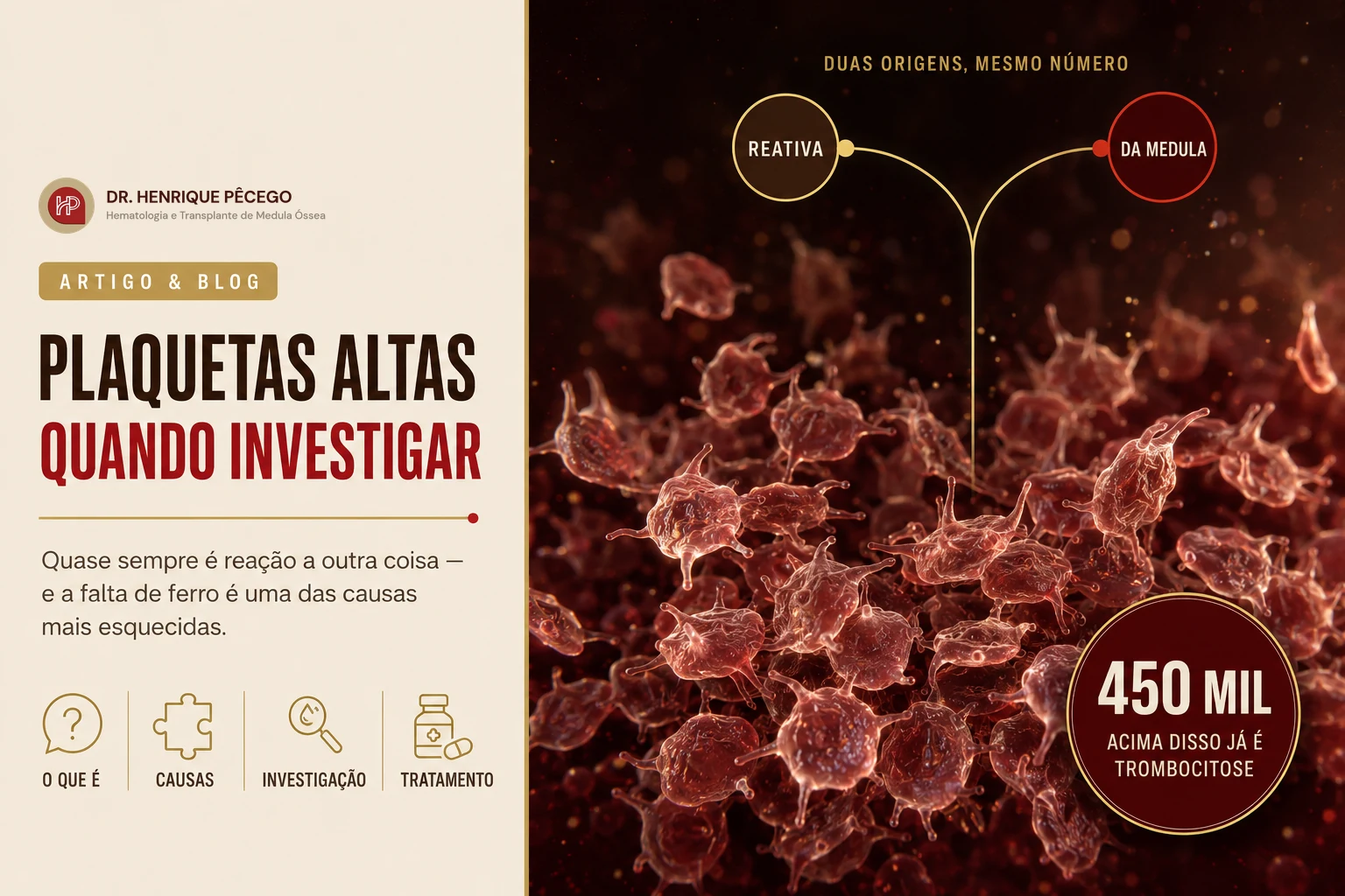 Plaquetas altas: o que significa e quando investigar