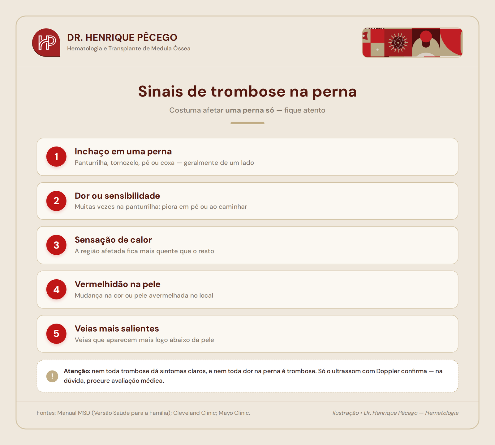 Infográfico com os sinais de trombose na perna: inchaço em uma perna, dor na panturrilha, calor, vermelhidão e veias salientes