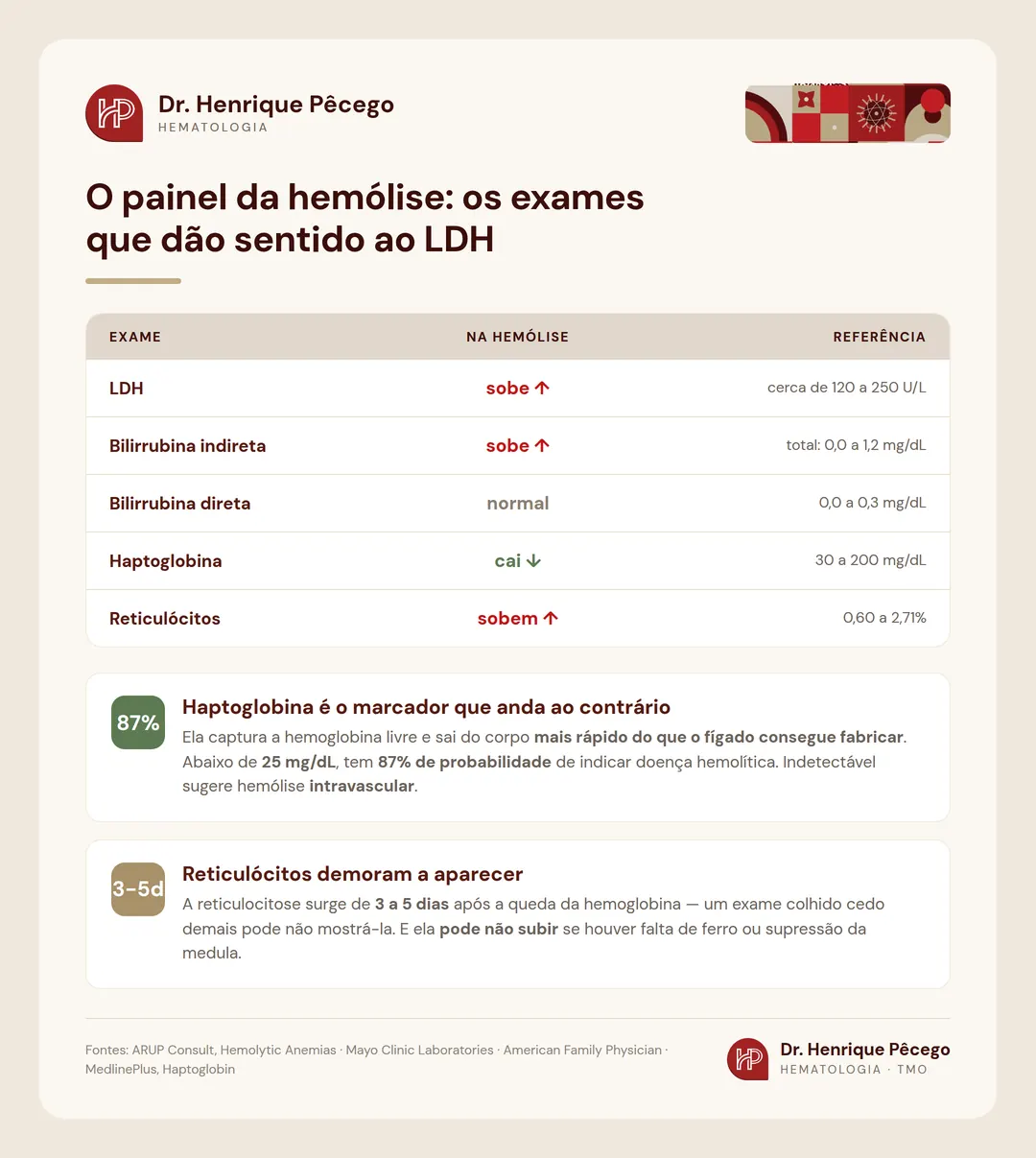 O painel da hemólise: LDH, bilirrubina indireta e reticulócitos sobem enquanto a haptoglobina cai, com as faixas de referência de cada exame