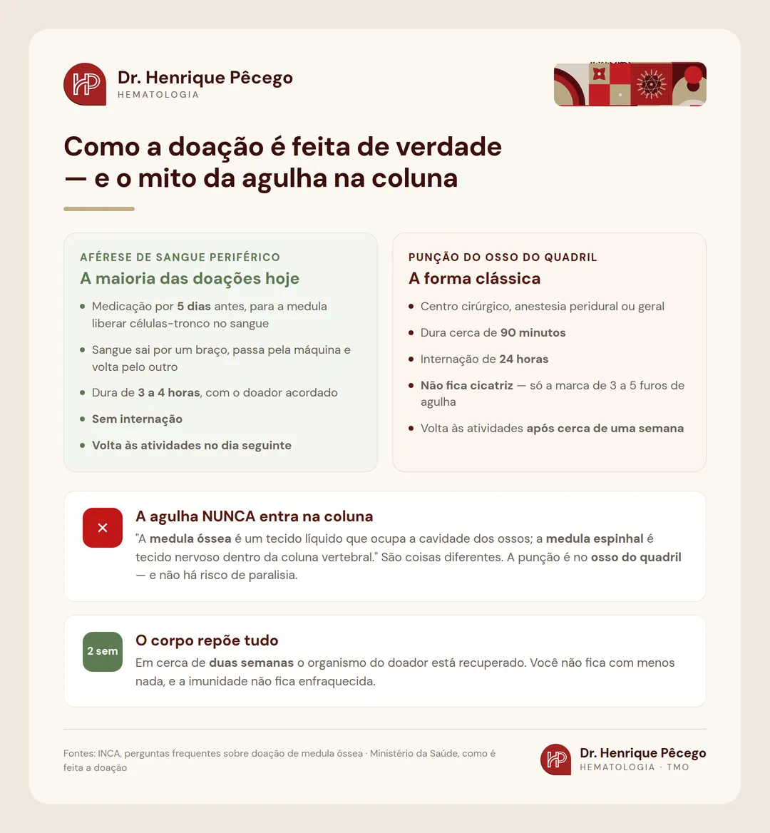 As duas formas de doar medula óssea: aférese de sangue periférico e punção do osso do quadril, e por que a agulha nunca entra na coluna