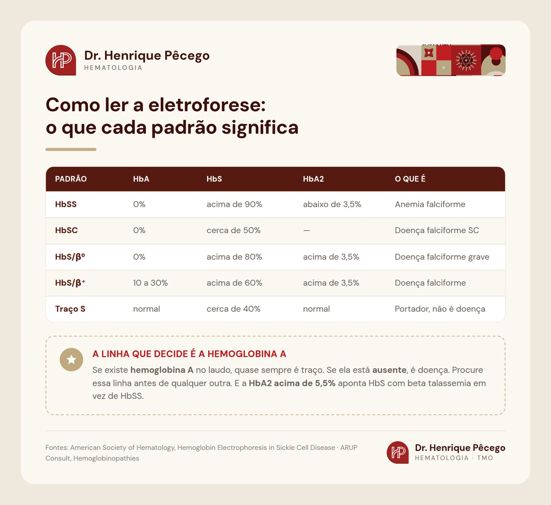 Tabela com os padrões da eletroforese: HbSS, HbSC, HbS beta zero, HbS beta mais e traço falciforme, com os valores de HbA, HbS e HbA2 de cada um