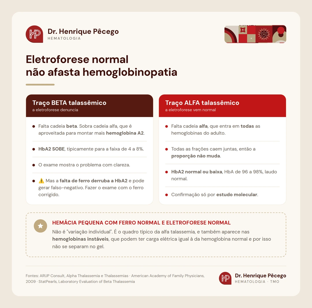 Comparação entre traço beta talassêmico, em que a HbA2 sobe e a eletroforese denuncia, e traço alfa talassêmico, em que a eletroforese vem normal