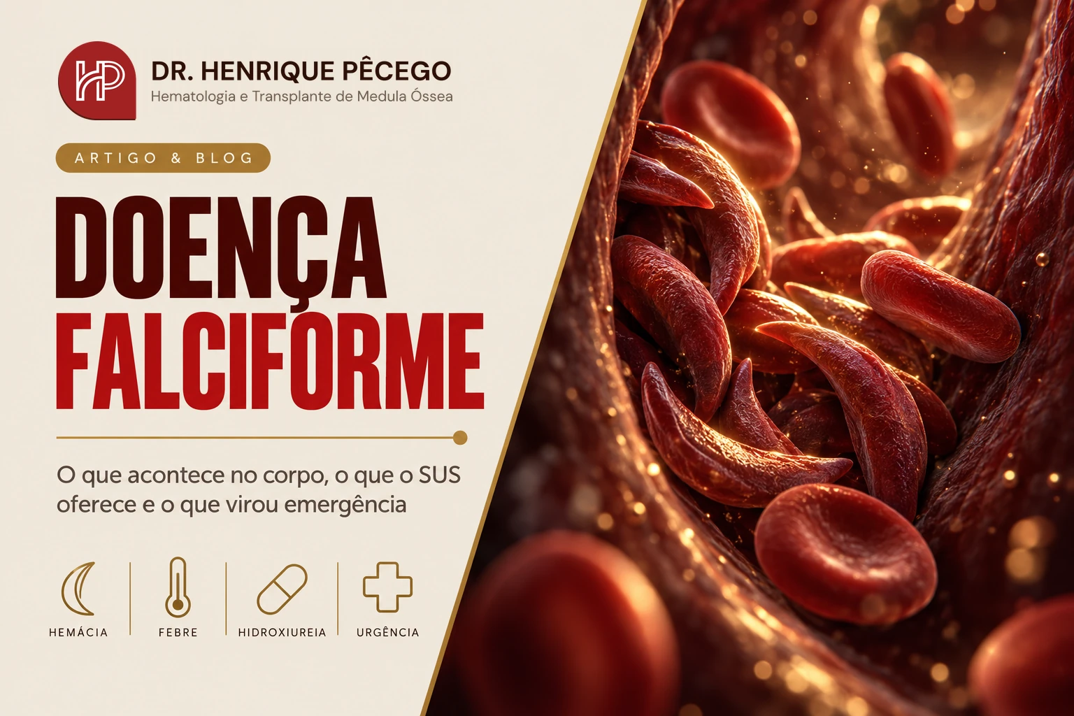 Doença falciforme: crises, tratamento e emergências