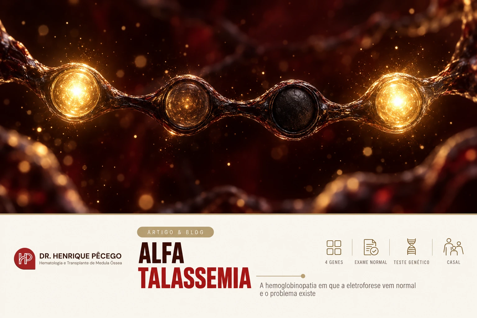 Alfa talassemia: quando a eletroforese vem normal