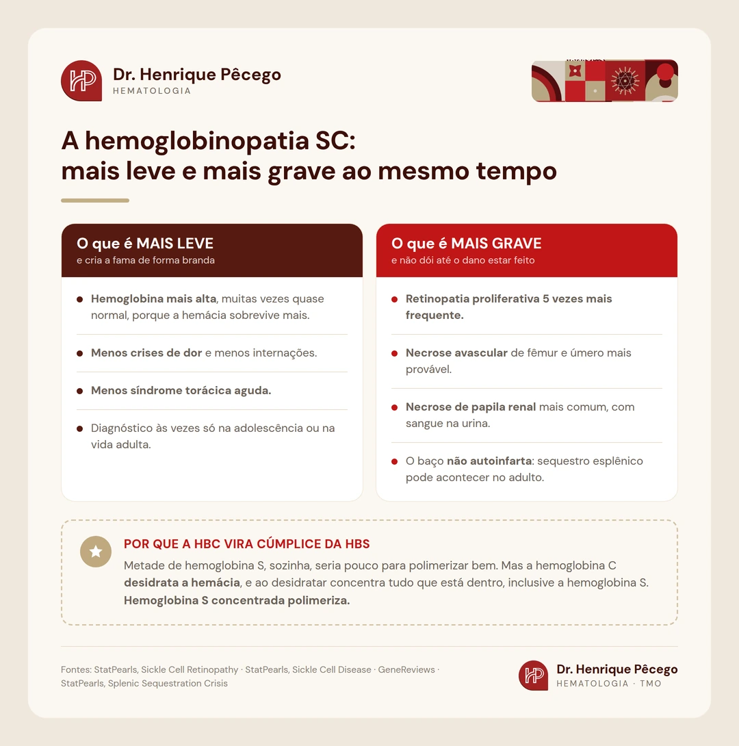 Comparação entre o que é mais leve e o que é mais grave na hemoglobinopatia SC, e a explicação de por que a hemoglobina C vira cúmplice da hemoglobina S