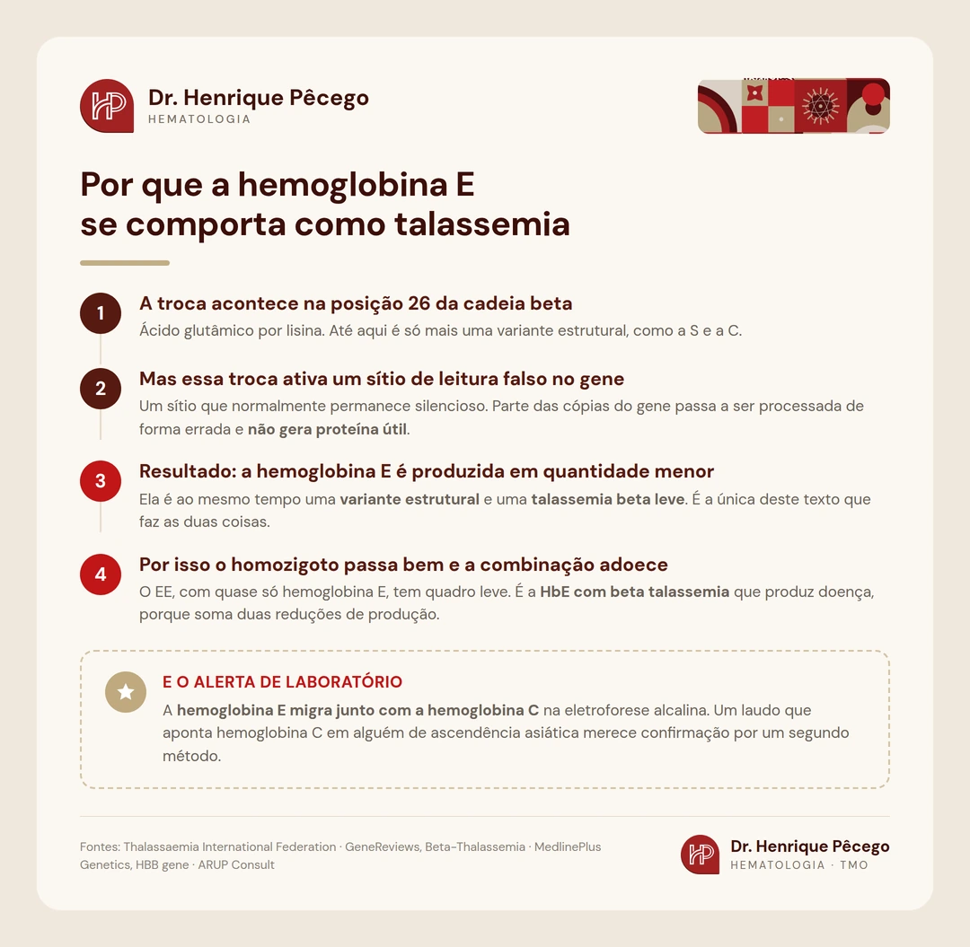 Roteiro em quatro passos explicando por que a hemoglobina E se comporta ao mesmo tempo como variante estrutural e como talassemia beta leve