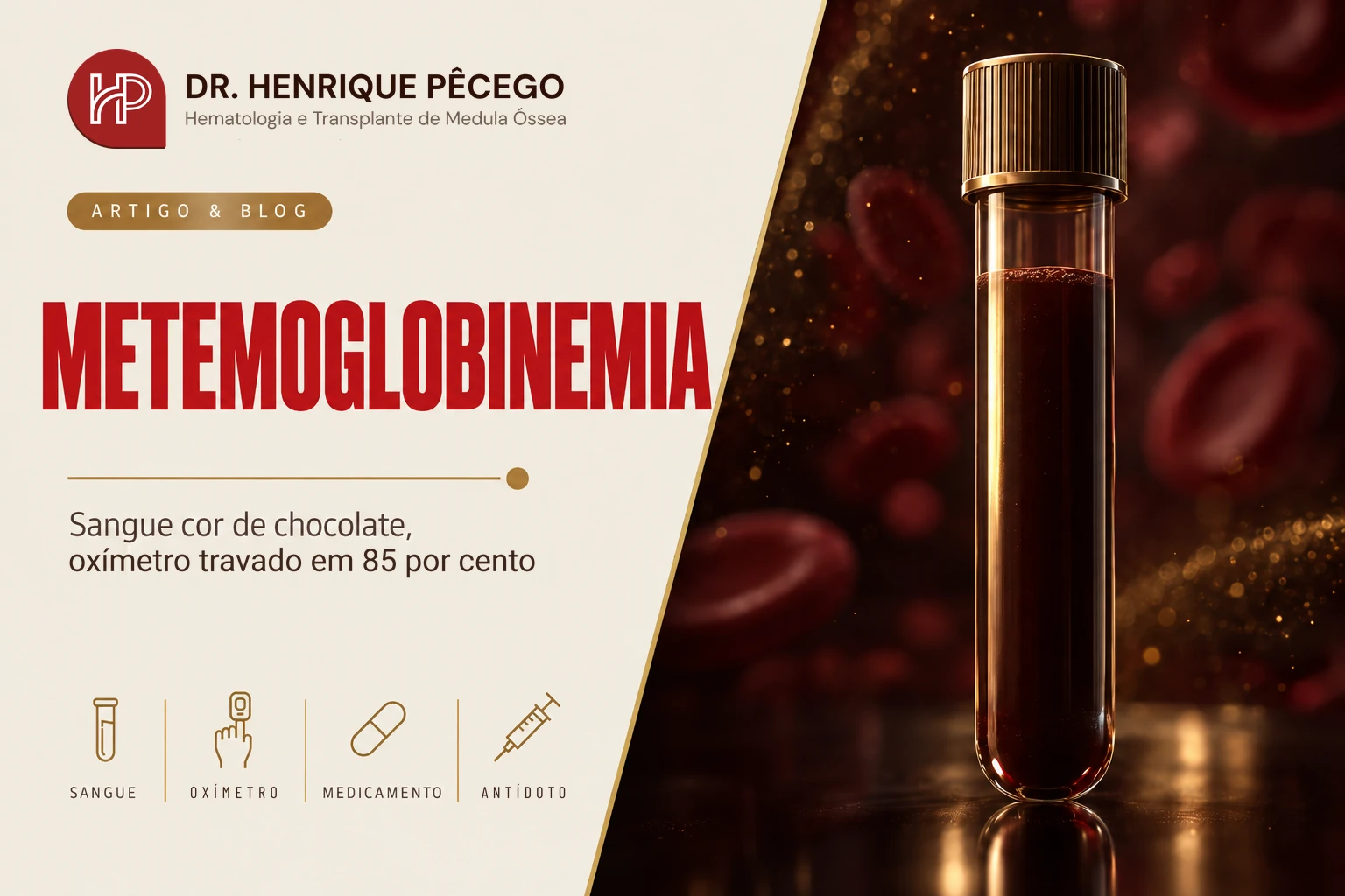 Metemoglobinemia: sangue cor de chocolate e oxímetro travado